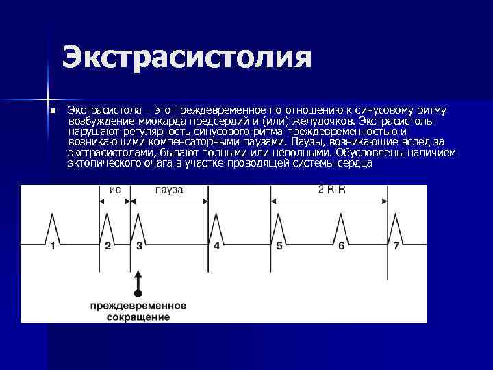 Умеренный ритм миокарда. Возбуждение миокарда. Блокированная экстрасистола. Блокада проведения возбуждения в миокарде. Ход возбуждения в миокарде.