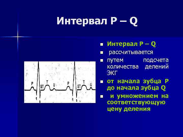 Интервал Р – Q n n n Интервал Р – Q рассчитывается путем подсчета