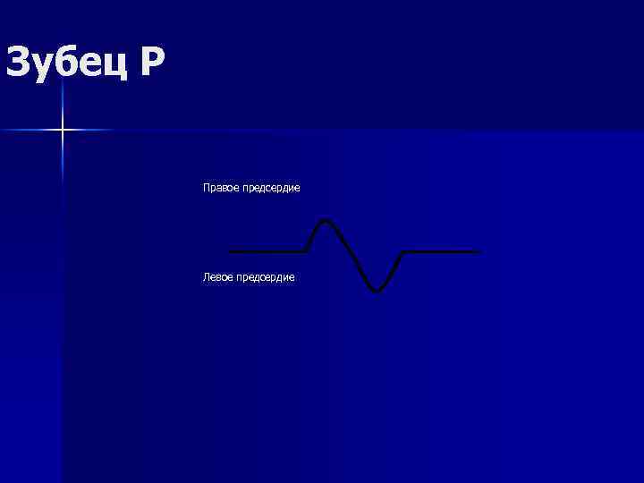 Зубец Р Правое предсердие Левое предсердие 