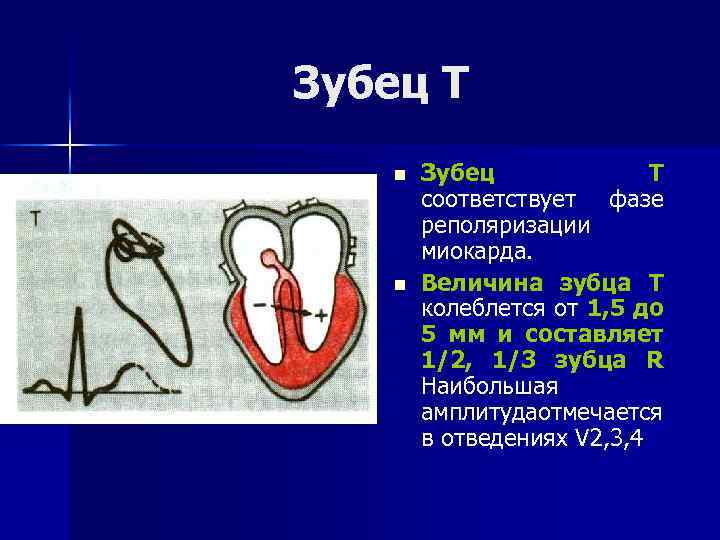 Зубец Т n n Зубец Т соответствует фазе реполяризации миокарда. Величина зубца Т колеблется