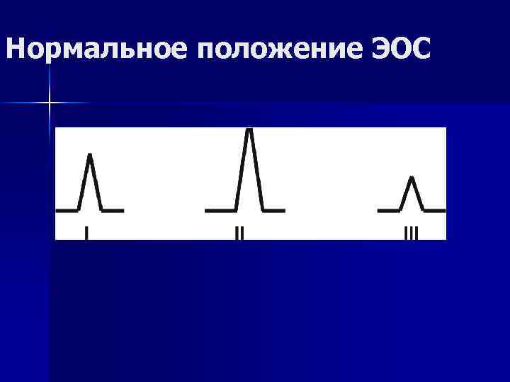 Нормальное положение ЭОС 