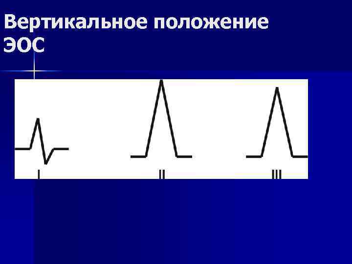 Вертикальное положение ЭОС 