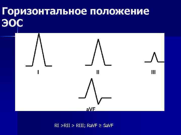 Горизонтальное положение ЭОС RI >RII > RIII; Ra. VF ≥ Sa. VF 