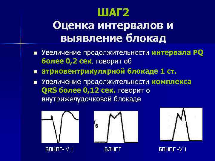 ШАГ 2 Оценка интервалов и выявление блокад n n n Увеличение продолжительности интервала РQ