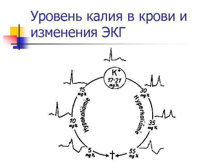 Уровень калия в крови и изменения ЭКГ 