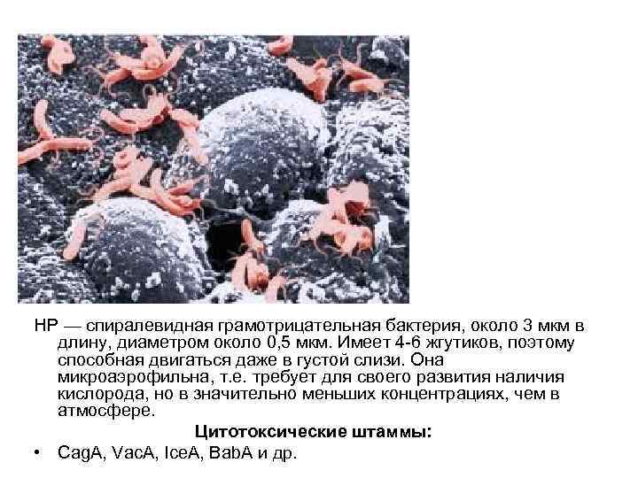 НР — спиралевидная грамотрицательная бактерия, около 3 мкм в длину, диаметром около 0, 5