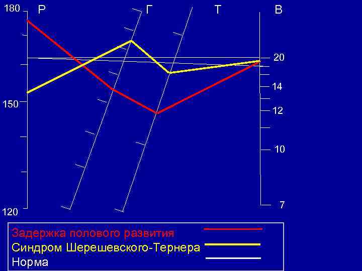 180 Р Г Т В 20 14 150 12 10 120 Задержка полового развития