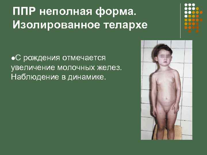 ППР неполная форма. Изолированное телархе l. С рождения отмечается увеличение молочных желез. Наблюдение в