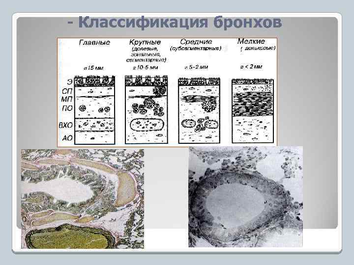 - Классификация бронхов 