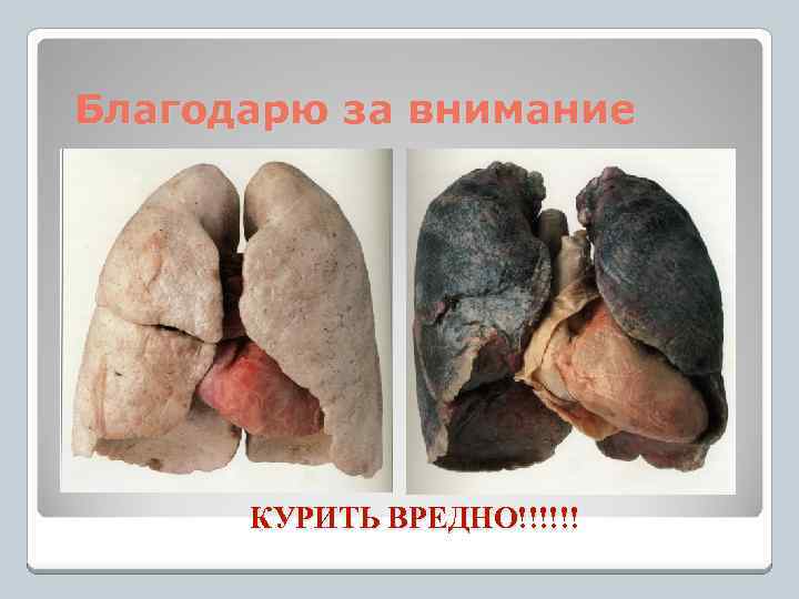 Благодарю за внимание КУРИТЬ ВРЕДНО!!!!!! 