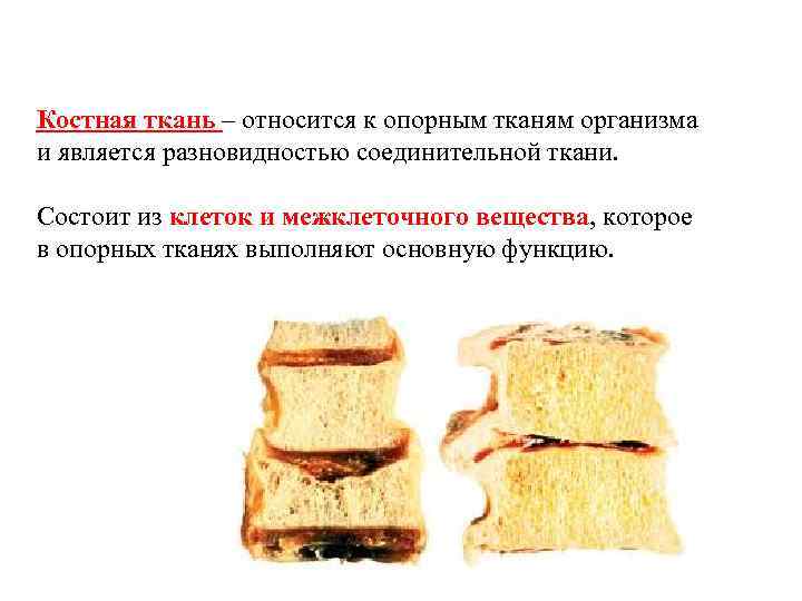 Костная ткань – относится к опорным тканям организма и является разновидностью соединительной ткани. Состоит