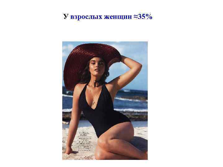 У взрослых женщин ≈35% 
