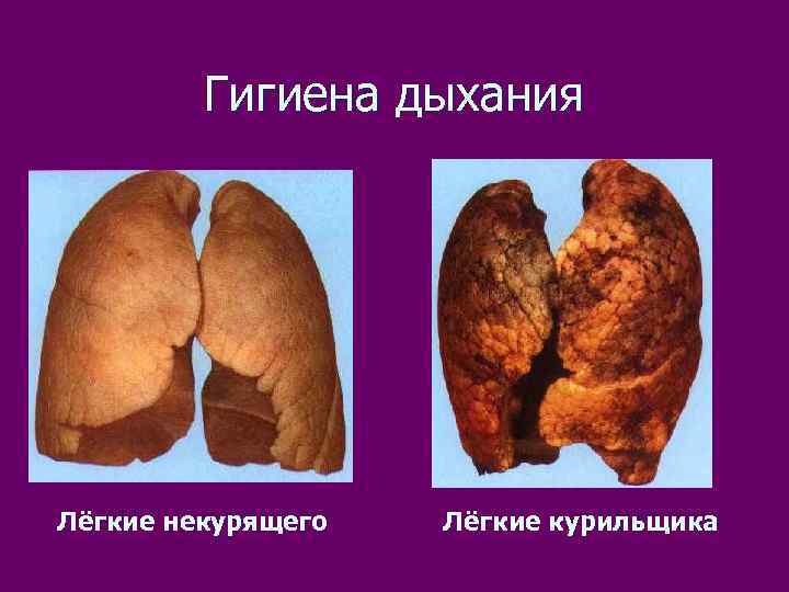 Гигиена дыхания Лёгкие некурящего Лёгкие курильщика 
