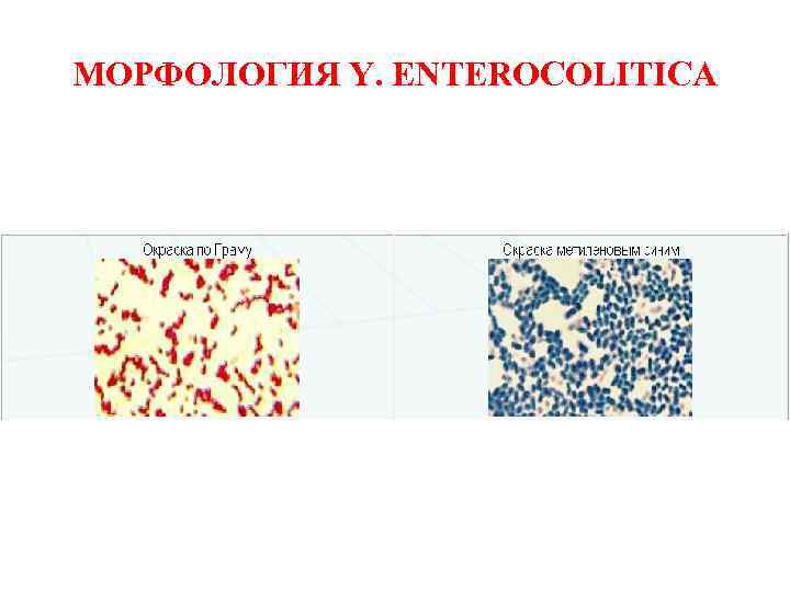 МОРФОЛОГИЯ Y. ENTEROCOLITICA 