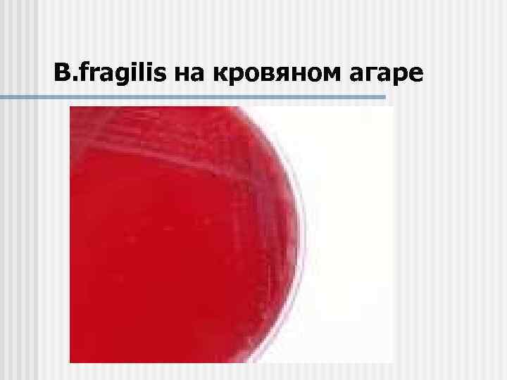 B. fragilis на кровяном агаре 