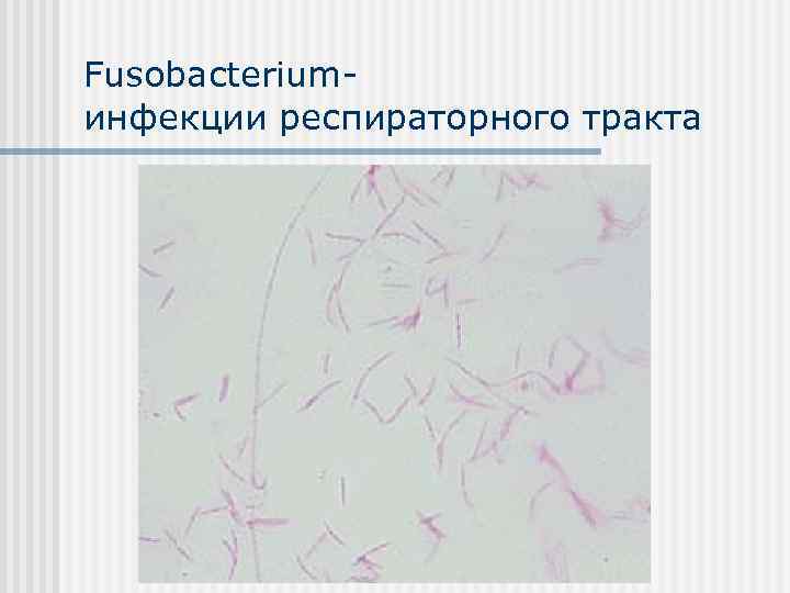 Fusobacteriumинфекции респираторного тракта 