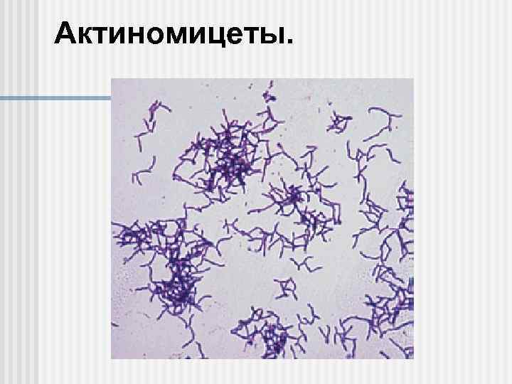 Актиномицеты. 
