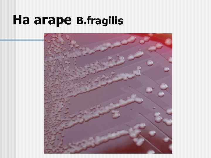 На агаре B. fragilis 
