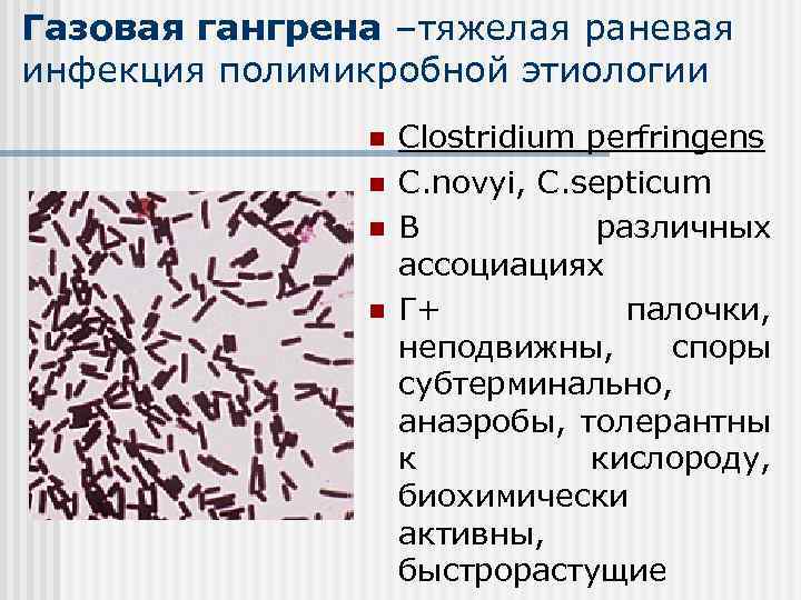 Гангрена Симптомы Фото Лечение