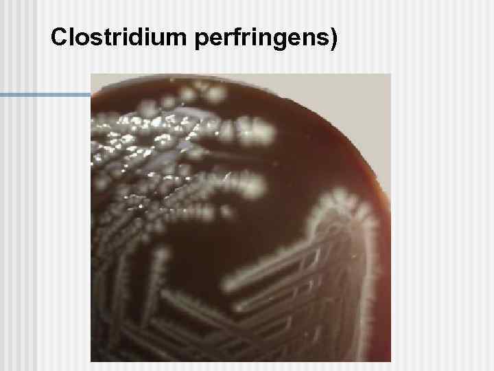 Симптом характерный для газовой гангрены тест. Клостридия перфрингенс газовая гангрена. Clostridium perfringens газовая гангрена. Среда Цейсслера микробиология газовая гангрена. Клостридия перфрингенс на среде Цейсслера.