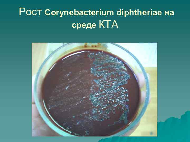 Рост Corynebacterium diphtheriae на среде КТА 