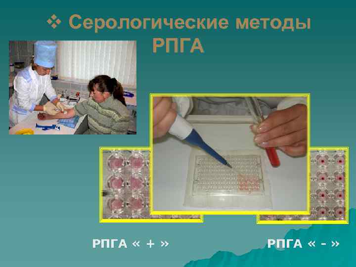 v Серологические методы РПГА « + » РПГА « - » 
