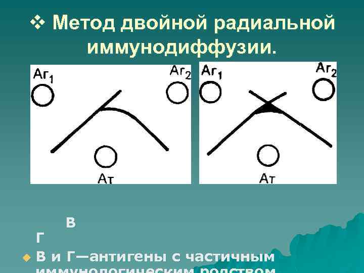 v Метод двойной радиальной иммунодиффузии. В Г u В и Г—антигены с частичным 