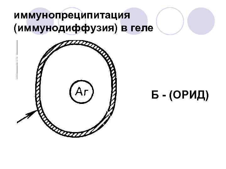 иммунопреципитация (иммунодиффузия) в геле Б - (ОРИД) 