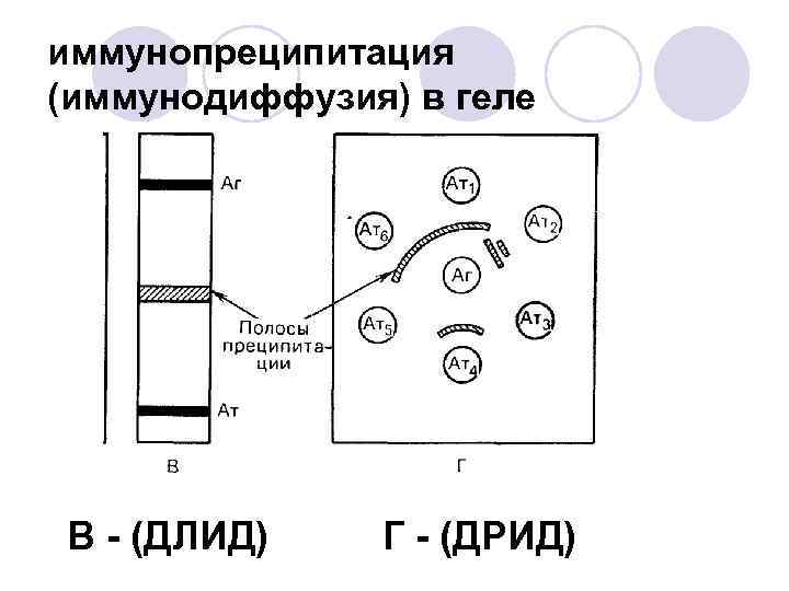 иммунопреципитация (иммунодиффузия) в геле В - (ДЛИД) Г - (ДРИД) 