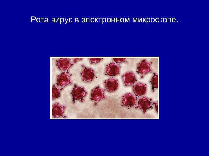 Рота вирус в электронном микроскопе. 