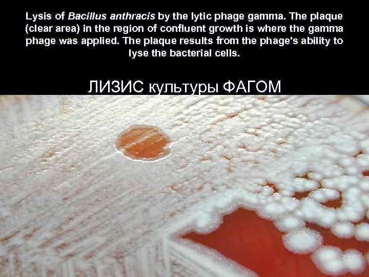 Lysis of Bacillus anthracis by the lytic phage gamma. The plaque (clear area) in