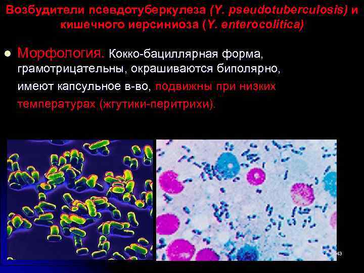 Возбудители псевдотуберкулеза (Y. pseudotuberculosis) и кишечного иерсиниоза (Y. enterocolitica) l Морфология. Кокко-бациллярная форма, грамотрицательны,