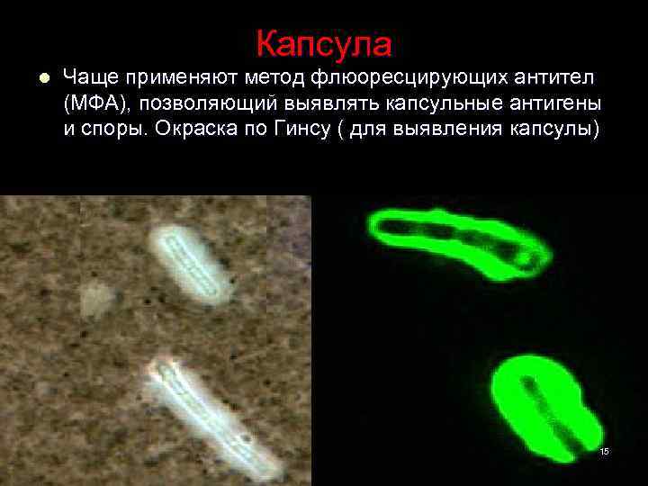 Капсула l Чаще применяют метод флюоресцирующих антител (МФА), позволяющий выявлять капсульные антигены и споры.