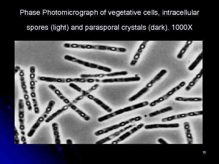 Phase Photomicrograph of vegetative cells, intracellular spores (light) and parasporal crystals (dark). 1000 X