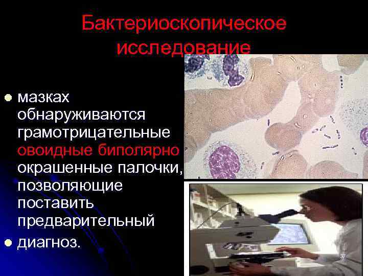Бактериоскопическое исследование мазках обнаруживаются грамотрицательные овоидные биполярно окрашенные палочки, позволяющие поставить предварительный l диагноз.