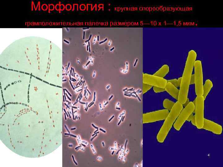 Морфология : крупная спорообразующая . грамположительная палочка размером 5— 10 х 1— 1, 5