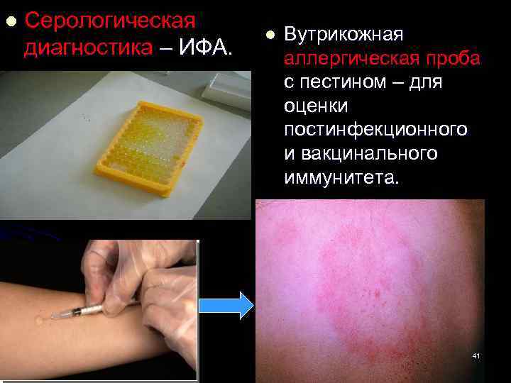 l Серологическая l Вутрикожная диагностика – ИФА. аллергическая проба с пестином – для оценки
