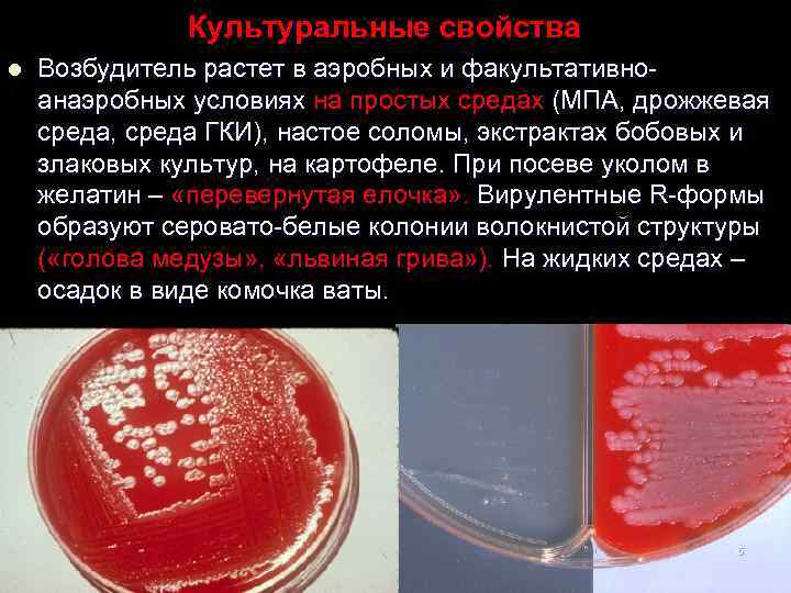 Культуральные свойства l Возбудитель растет в аэробных и факультативноанаэробных условиях на простых средах (МПА,