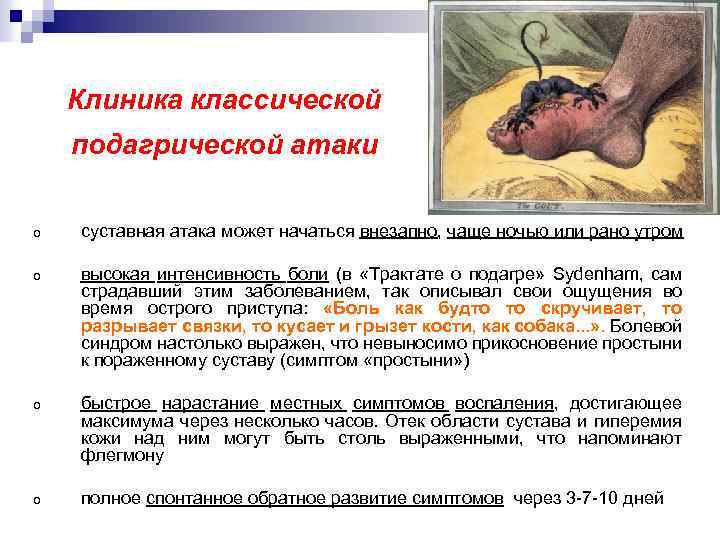 Клиника классической подагрической атаки o суставная атака может начаться внезапно, чаще ночью или рано
