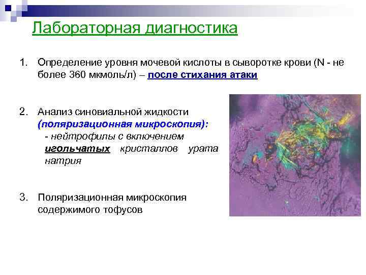 Лабораторная диагностика 1. Определение уровня мочевой кислоты в сыворотке крови (N - не более