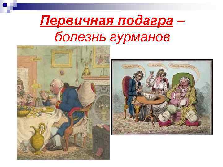 Первичная подагра – болезнь гурманов 