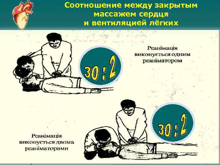Соотношение между закрытым массажем сердця и вентиляцией лёгких 