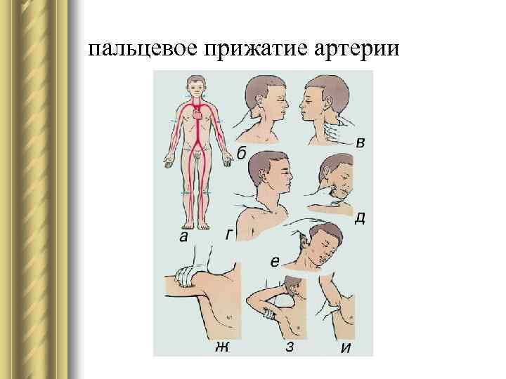 пальцевое прижатие артерии 