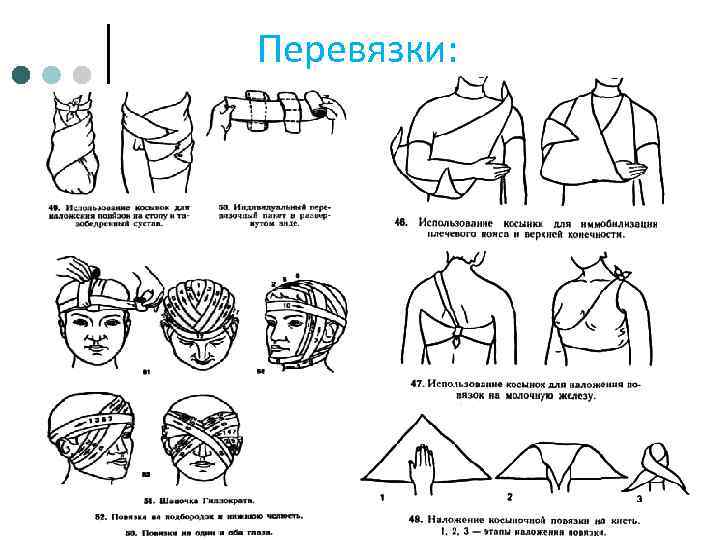 Перевязки: 
