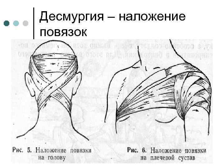 Десмургия в картинках