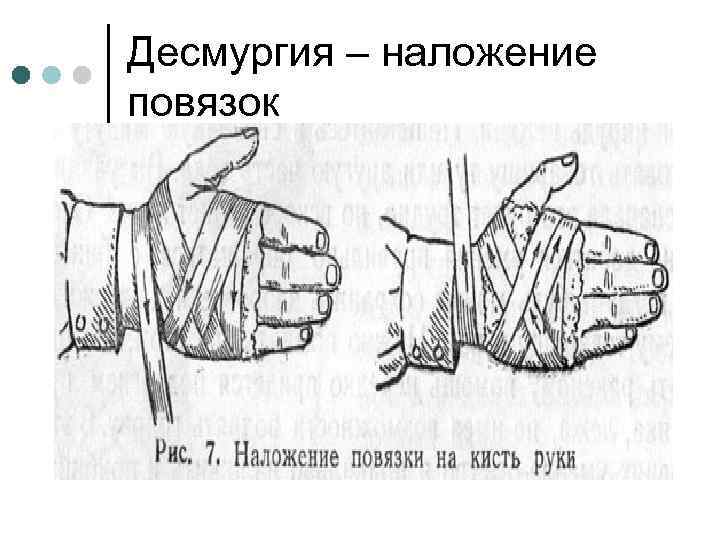 Десмургия – наложение повязок 