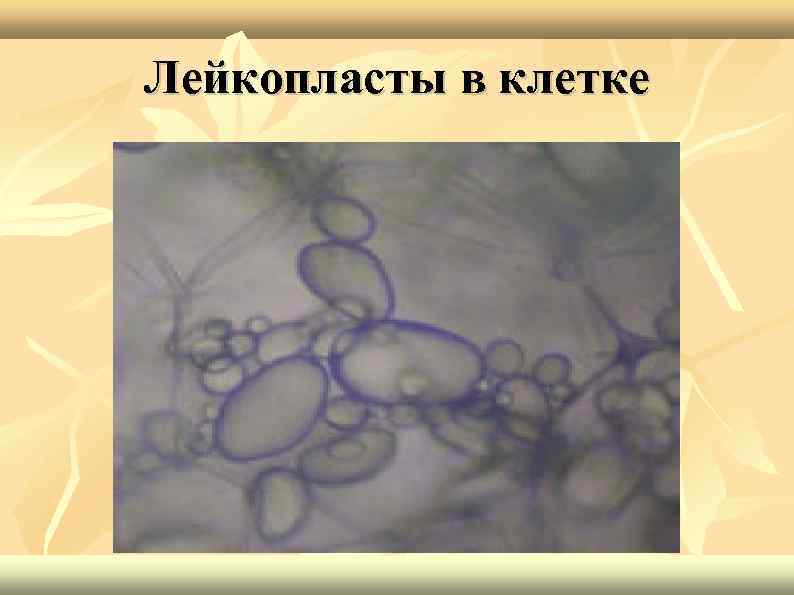 Лейкопласты в растительной клетке. Лейкопласты клубня картофеля. Крахмальные зерна клубня картофеля под микроскопом. Лейкопласты под микроскопом. Крахмальные зерна под микроскопом.