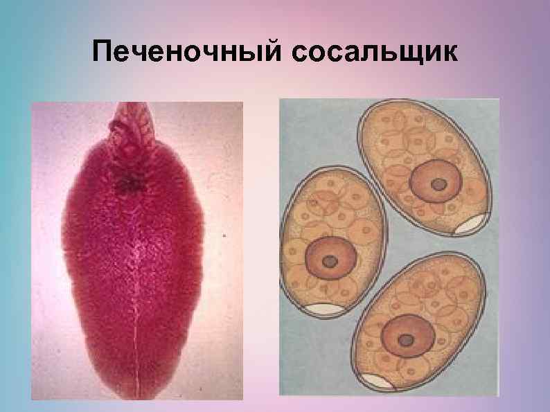 Печеночный сосальщик 