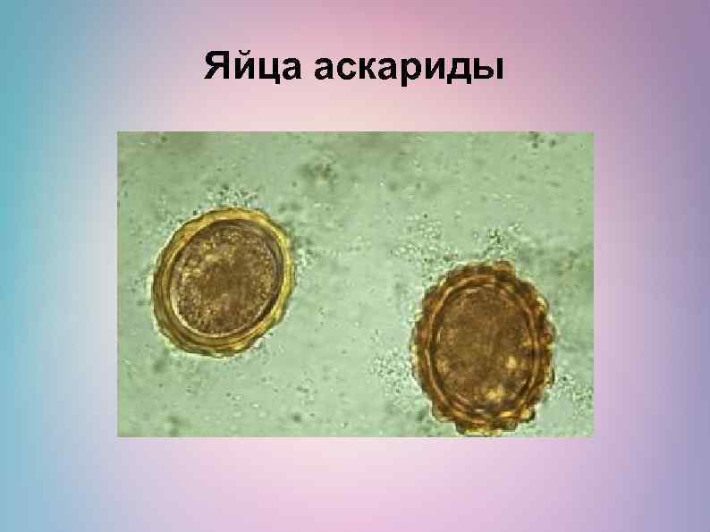 Яйца аскариды 