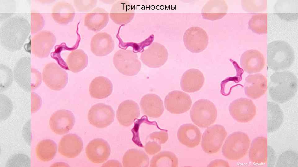 Трипаносомы Myron G. Schultz 